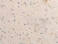 PPM1D Polyclonal Antibody – Figure 1 of 3