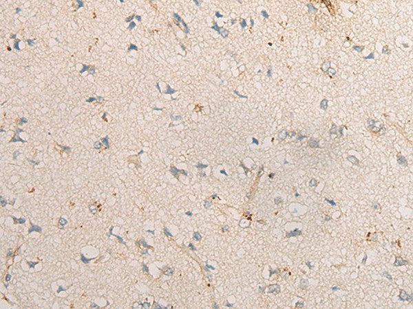 PPM1D Polyclonal Antibody – Figure 1 of 3