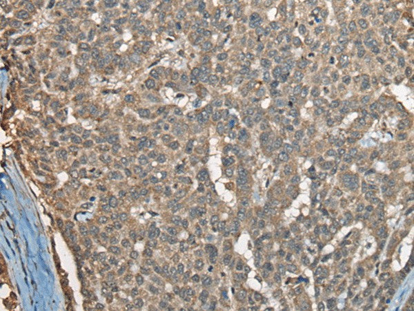 COX7A2L Polyclonal Antibody – Figure 1 of 2