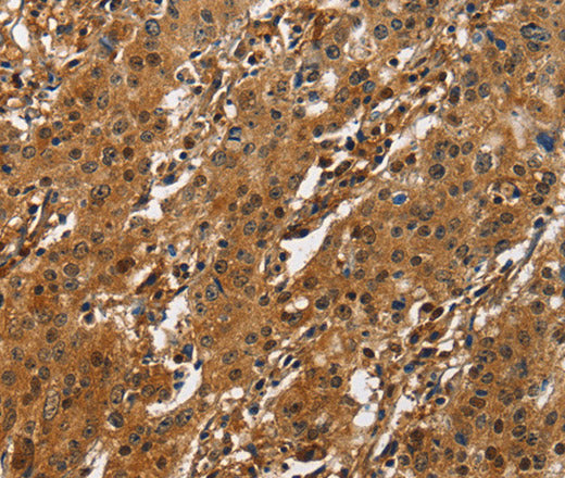 CREB2 Polyclonal Antibody – Figure 1 of 3