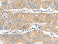 DNAL1 Polyclonal Antibody – Figure 1 of 3
