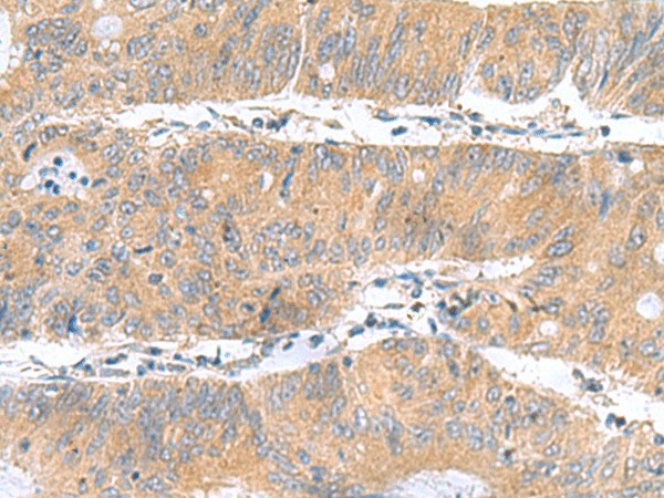 DNAL1 Polyclonal Antibody – Figure 1 of 3