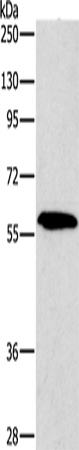 PAK2 Polyclonal Antibody – Figure 1 of 4