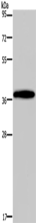 DLX4 Polyclonal Antibody – Figure 1 of 2