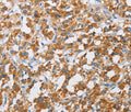 BDH1 Polyclonal Antibody – Figure 1 of 3