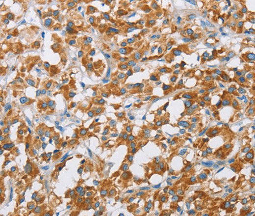 BDH1 Polyclonal Antibody – Figure 1 of 3