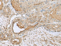 GABARAPL2 Polyclonal Antibody – Figure 1 of 2