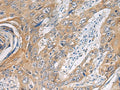 PA2G4 Polyclonal Antibody – Figure 1 of 3
