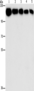 HK2 Polyclonal Antibody – Figure 1 of 4