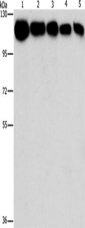 HK2 Polyclonal Antibody – Figure 1 of 4