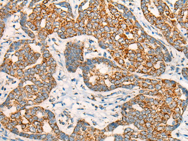 CCT8L2 Polyclonal Antibody – Figure 1 of 3