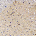 NOS2 Polyclonal Antibody – Figure 1 of 3