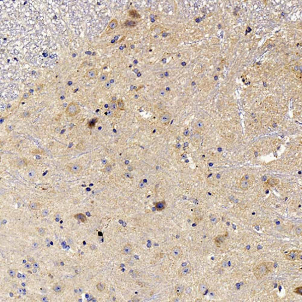 NOS2 Polyclonal Antibody – Figure 1 of 3