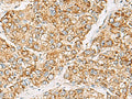 ZPBP2 Polyclonal Antibody – Figure 1 of 3