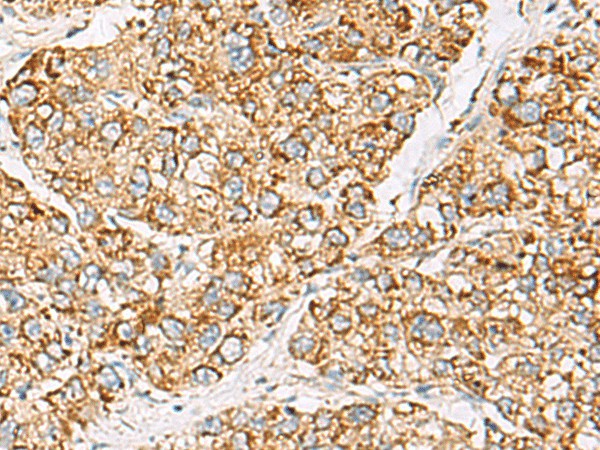 ZPBP2 Polyclonal Antibody – Figure 1 of 3