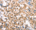 LATS2 Polyclonal Antibody – Figure 1 of 3