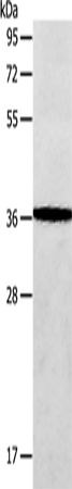 AASDHPPT Polyclonal Antibody – Figure 1 of 4