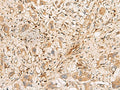 PLCB2 Polyclonal Antibody – Figure 1 of 2