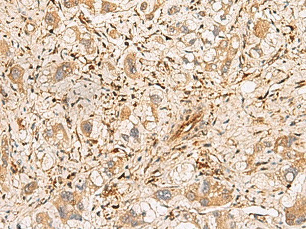 PLCB2 Polyclonal Antibody – Figure 1 of 2