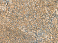 SSSCA1 Polyclonal Antibody – Figure 1 of 3