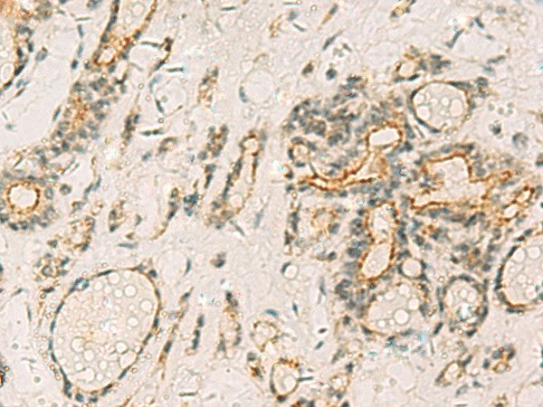 HORMAD2 Polyclonal Antibody – Figure 1 of 3