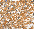 ANKMY2 Polyclonal Antibody – Figure 1 of 3