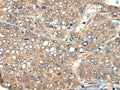 ACER1 Polyclonal Antibody – Figure 1 of 2