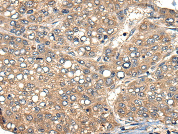 ACER1 Polyclonal Antibody – Figure 1 of 2