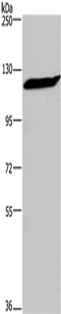IPO7 Polyclonal Antibody – Figure 1 of 4