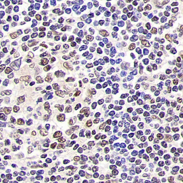 SIRT1 Polyclonal Antibody – Figure 1 of 4