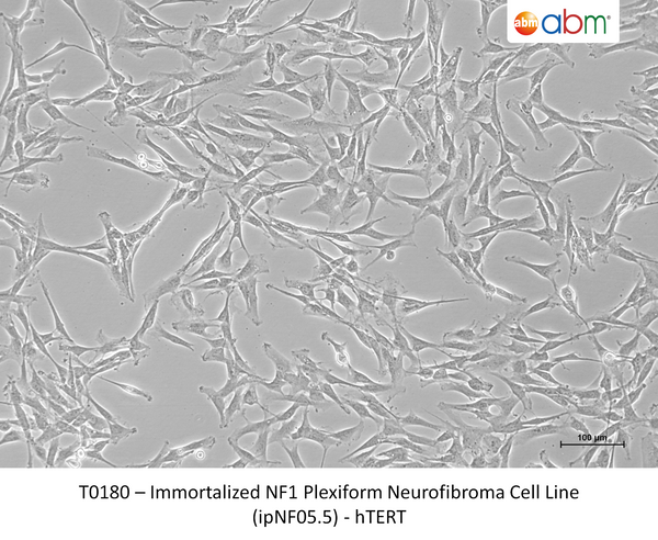 Immortalized NF1 Plexiform Neurofibroma Cell Line (ipNF05.5) - hTERT – Figure 1 of 1