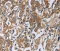 PRL Polyclonal Antibody – Figure 1 of 2