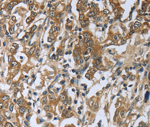 PRL Polyclonal Antibody – Figure 1 of 2