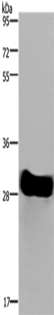 FHL2 Polyclonal Antibody – Figure 1 of 4
