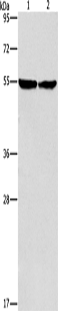 ILK Polyclonal Antibody – Figure 1 of 4