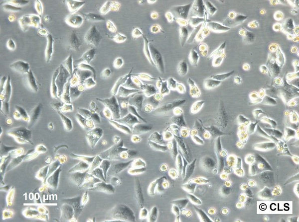 RCC-ER cell