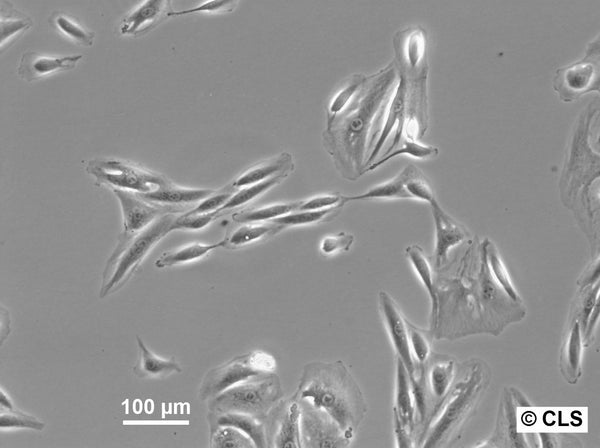 RCC-GH cell