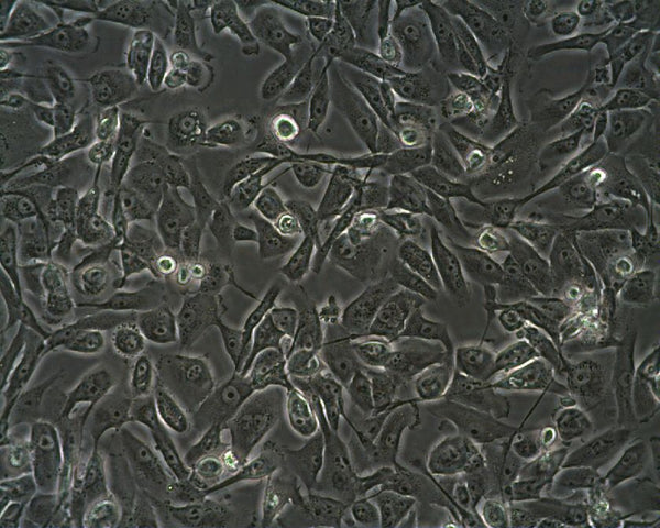 RCC-GS cell