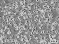 RCC-HB cell