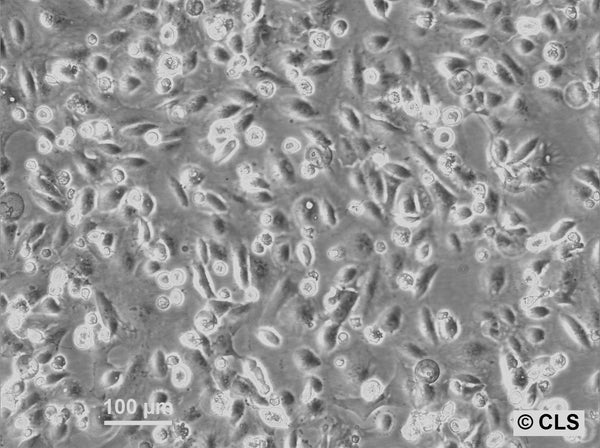 RCC-HB cell
