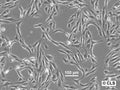 RCC-JF cell