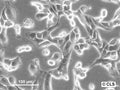 RCC-KL cell