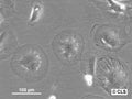 RCC-KP cell