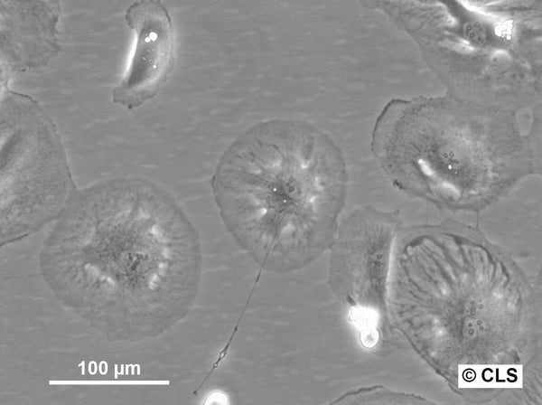 RCC-KP cell