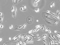 RCC-LR cell