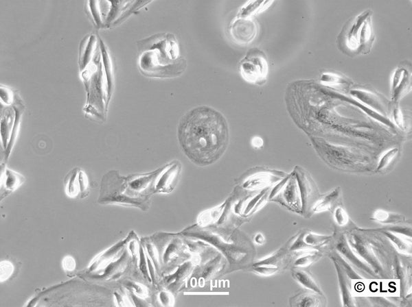RCC-LR cell