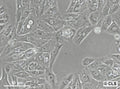 RCC-MF cell