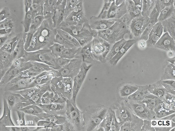 RCC-MF cell
