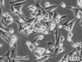 RCC-MH cell