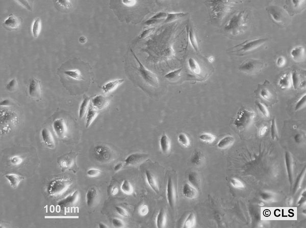 RCC-PR cell